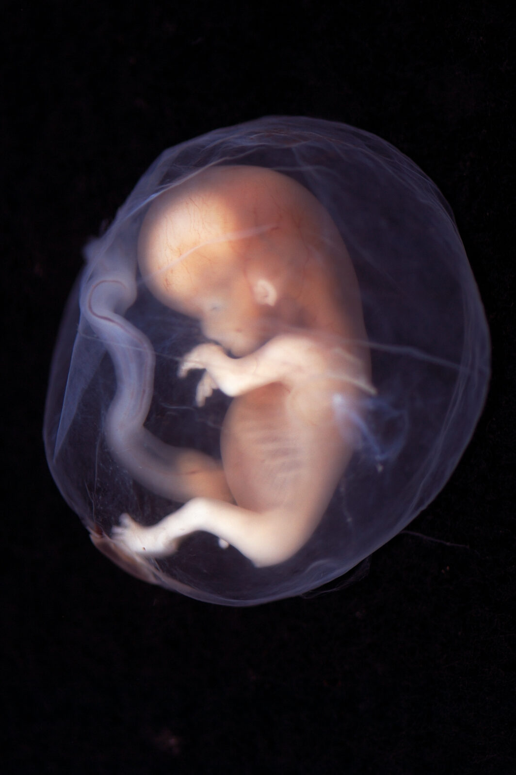 Human Fetus Week Nine