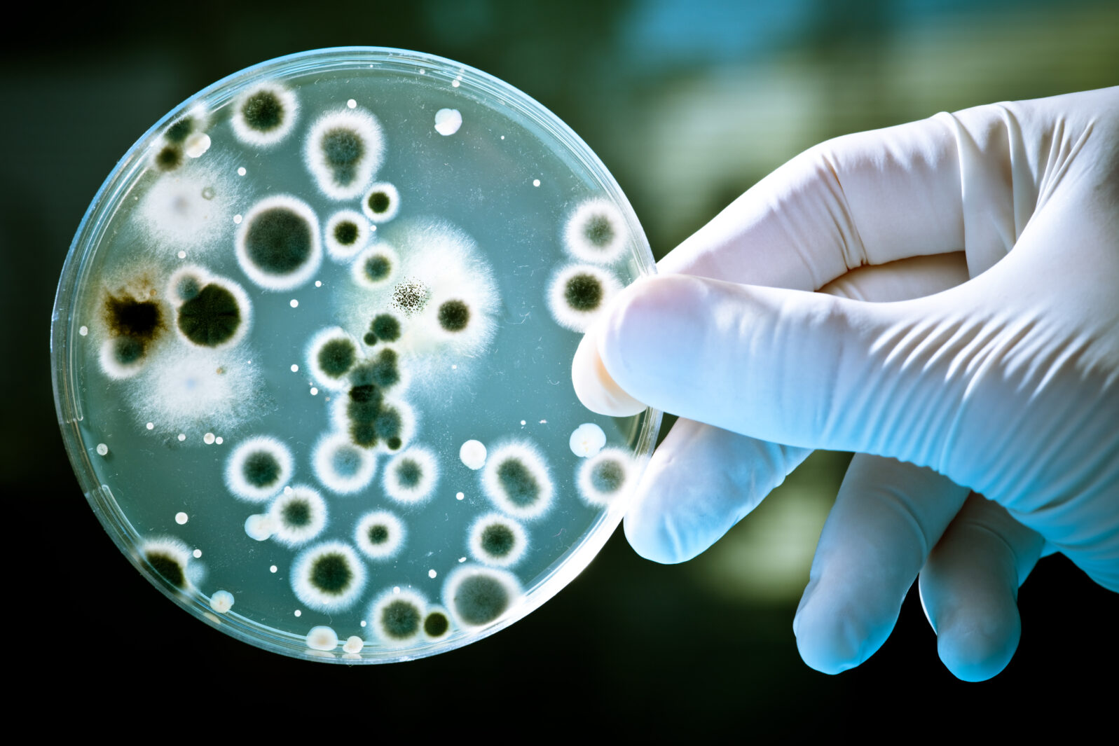 Bacteria in Petri dish