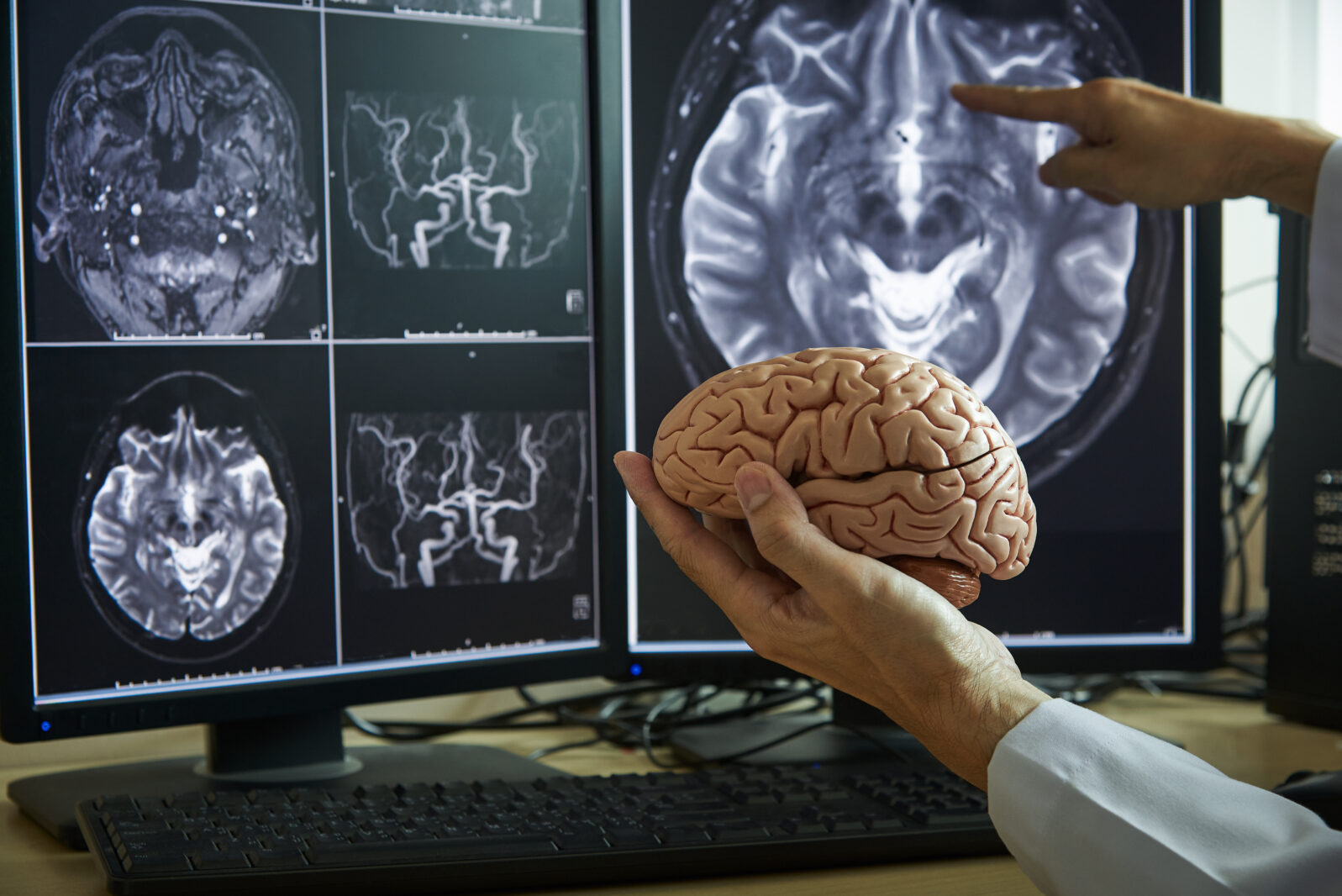 Doctor demonstrating human brain anatomy and MRI brain on background