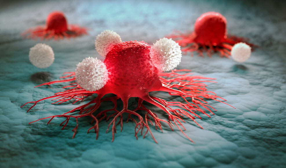 Tumor cell under attack of white blood cells