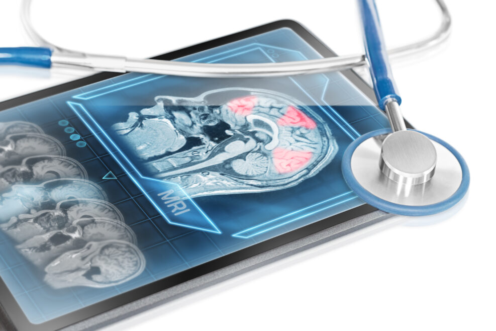 Medical tablet displaying cerebral activity