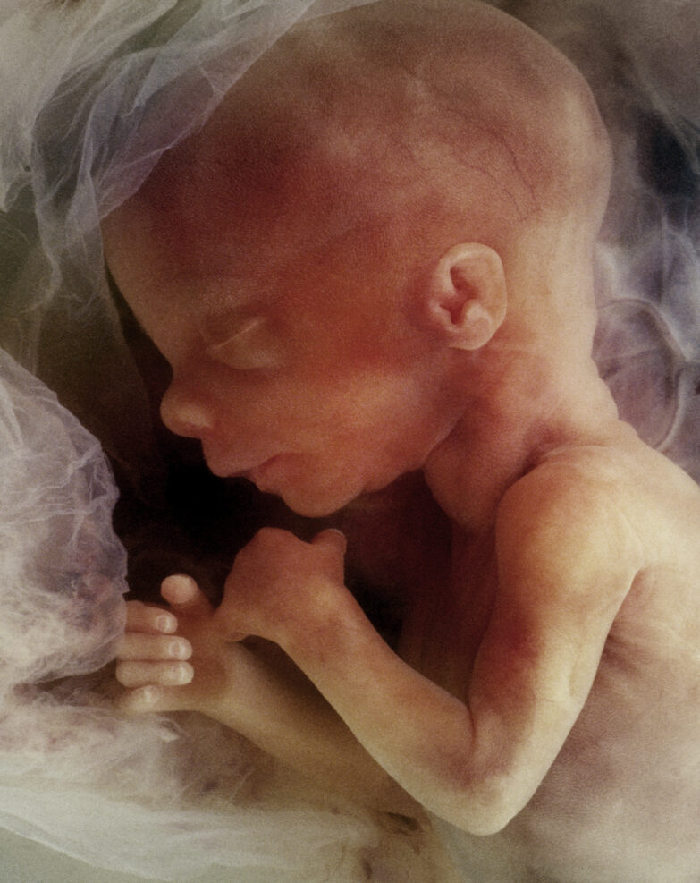 In-vitro image of a human fetus
