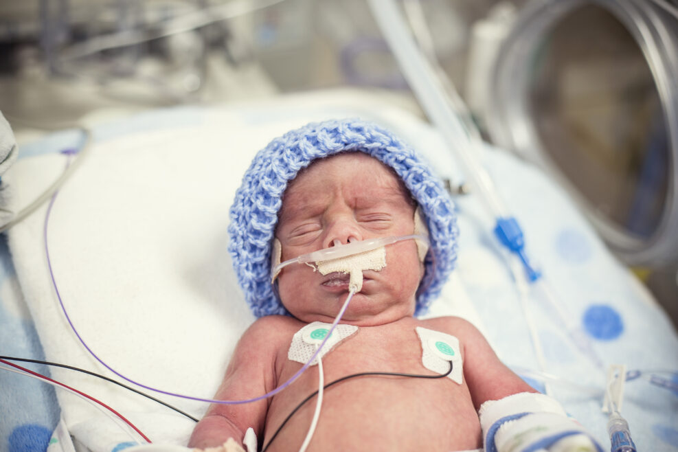 Newborn premature baby in the NICU intensive care