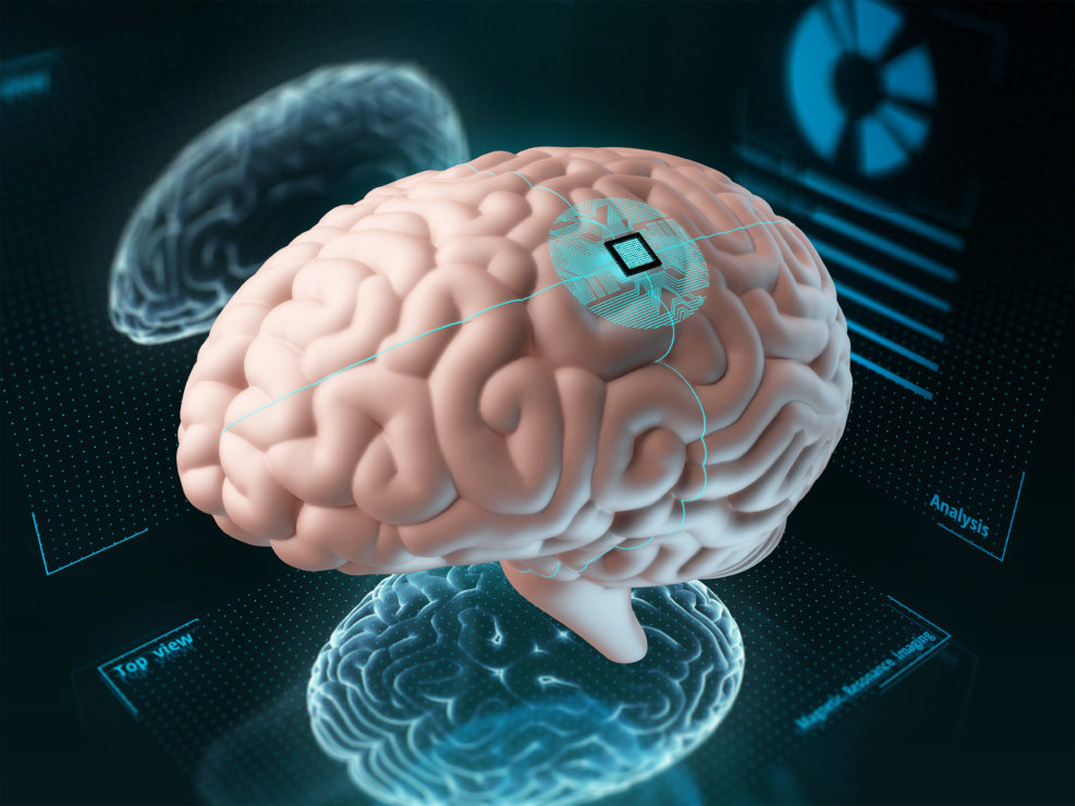 Human brain with an implanted chip.