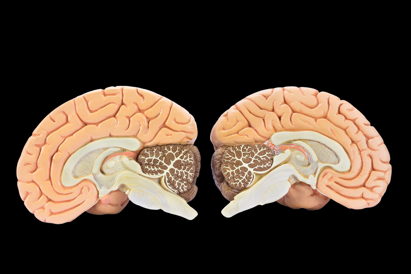 Models of two brain halves on black background