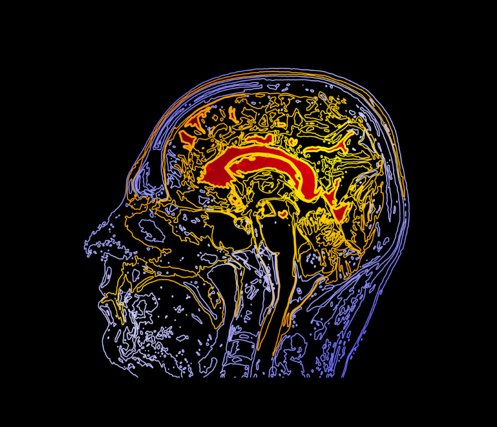 Topographic map MRI of the human brain.