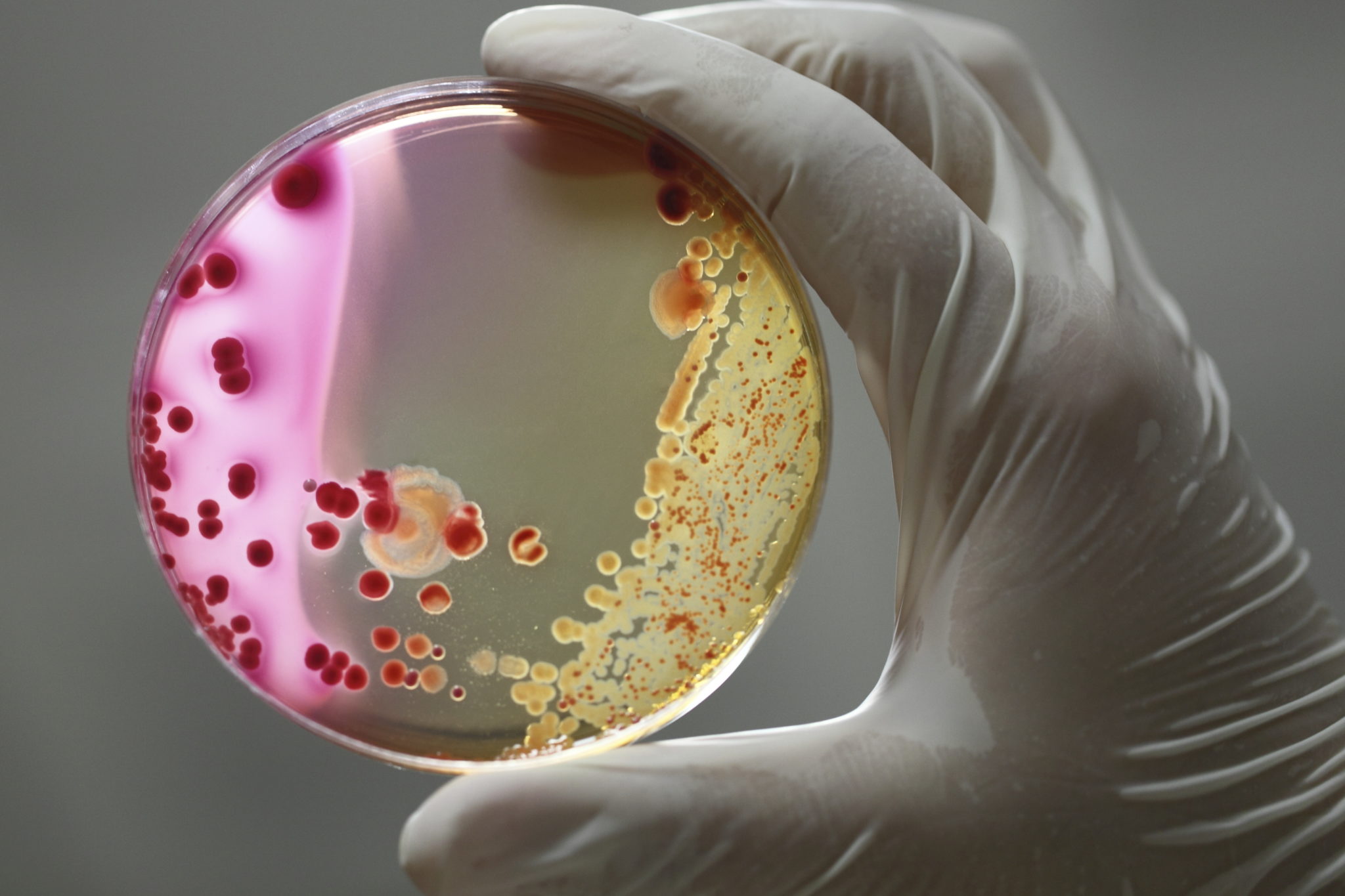bacteria