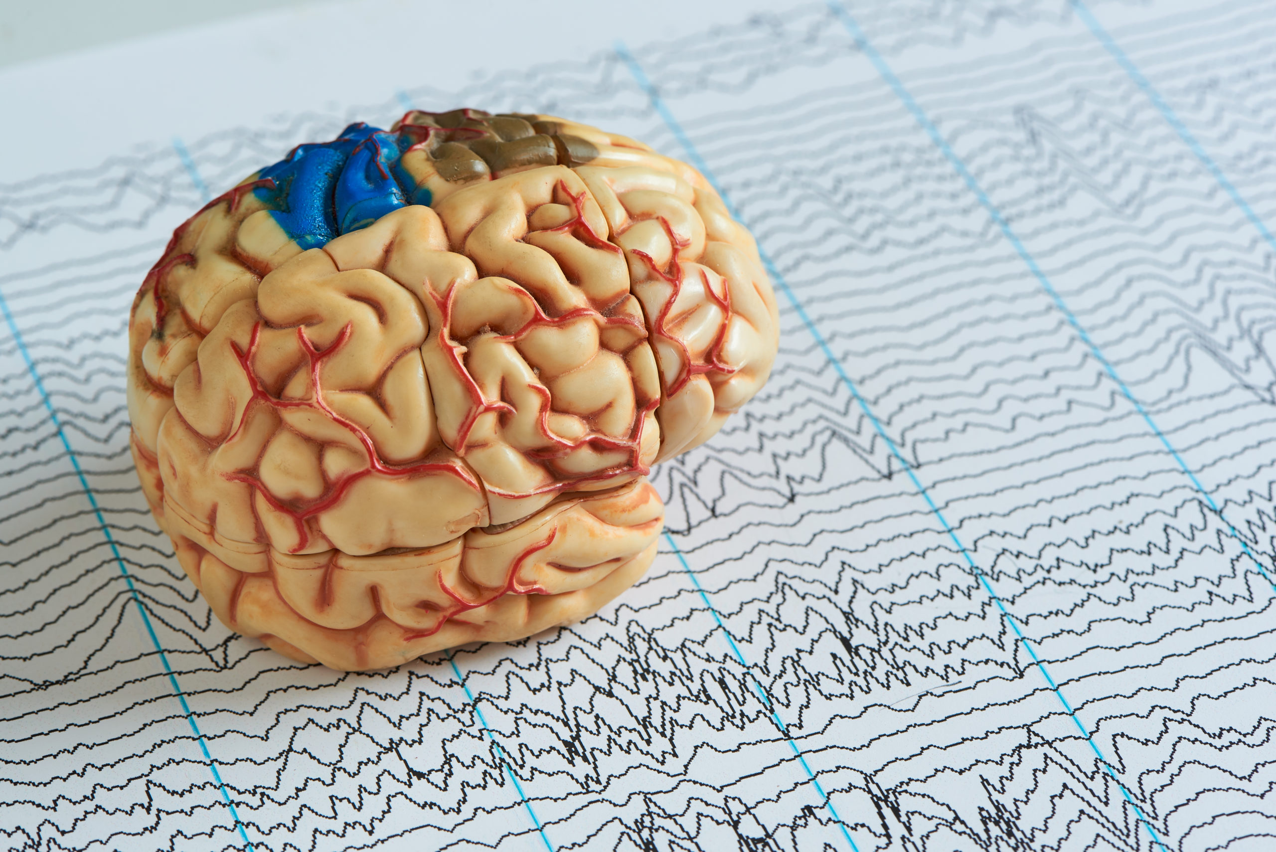 Finding God in the Brain