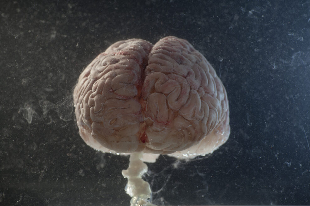 Human brain is floating in a tank of water with lots of suspended particles
