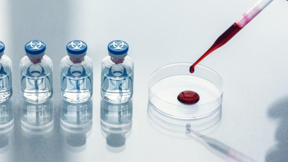 Prohibited development of bioweapon in a lab. A dropper and a Petri dishes with human blood sample and a row of ampoules with a bio-hazard sign, close-up, selected focus.