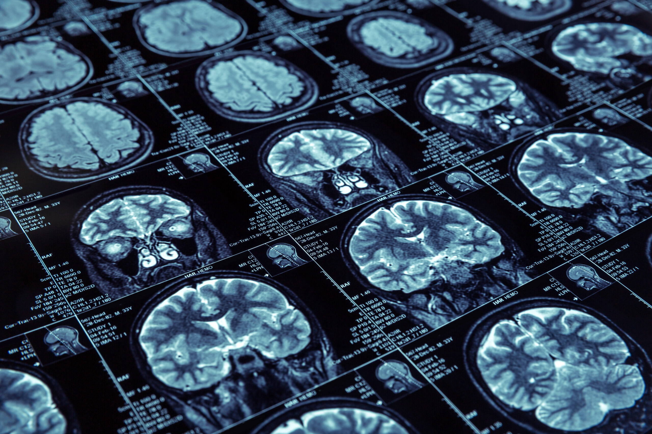 Healing the Brain: Insights from a Neurologist