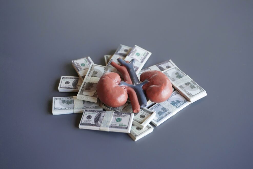 Human kidney and money. Buy and sell human organ, healthcare, medical expenses concept