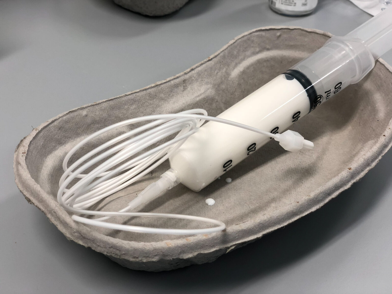 Syringe with anaesthetic drug - Propofol, ready for infusion.