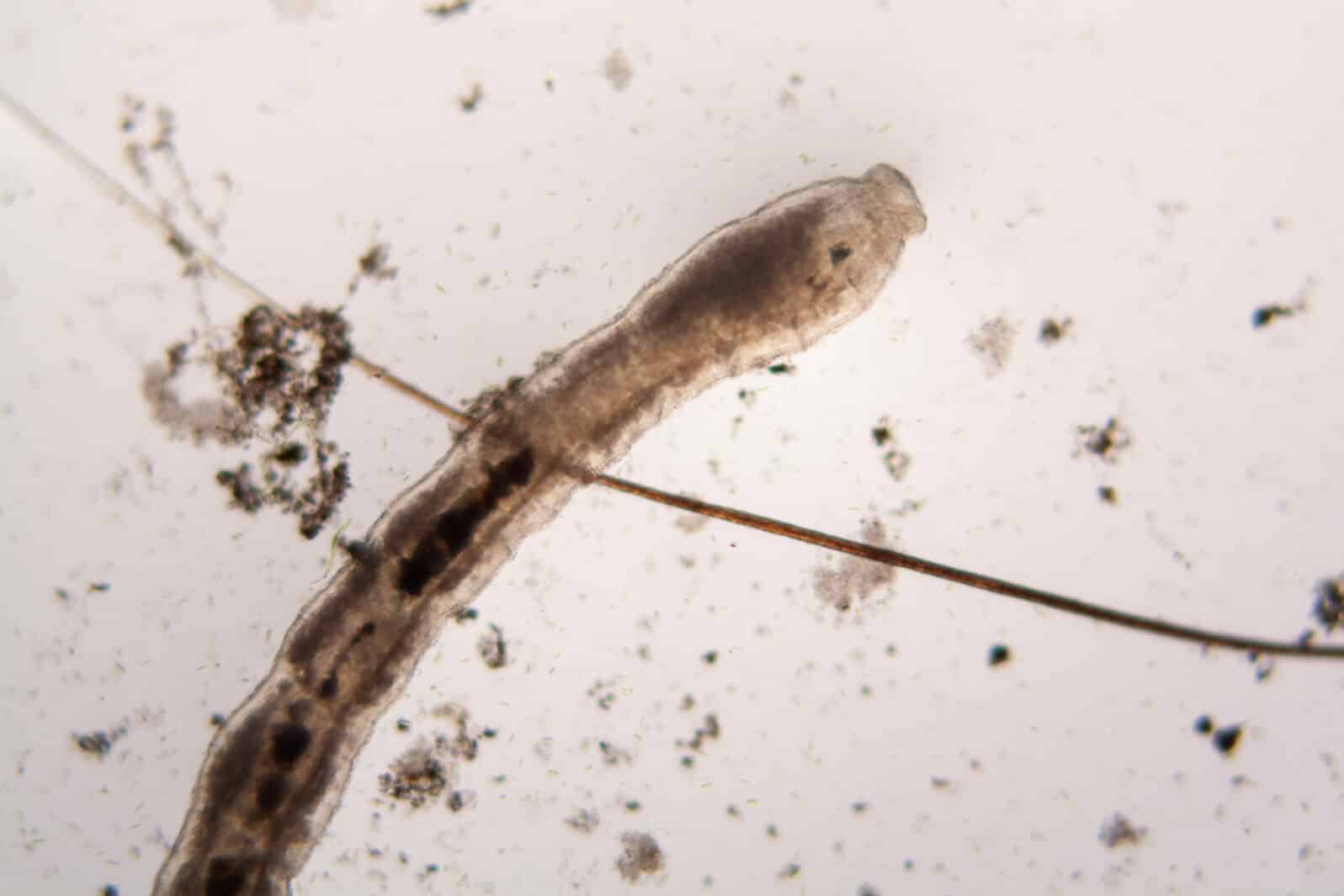 Microscopic organisms from the pond water. Nematode - details